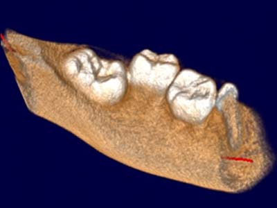 Insights Diagnostic CBCT Scan Services 5x5